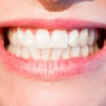 Przepiękne nienaganne zęby dodatkowo świetny cudny uśmieszek to powód do płenego uśmiechu.